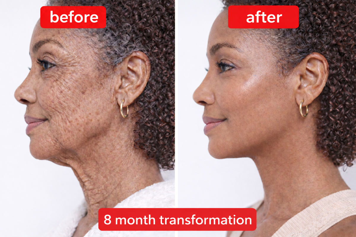 Civara ® Advanced 5x Peptide Anti-Aging Serum