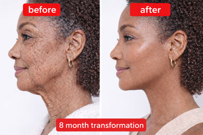 Civara ® Advanced 5x Peptide Anti-Aging Serum