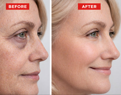 Civara ® 5x Retinol Alternative Eye Serum